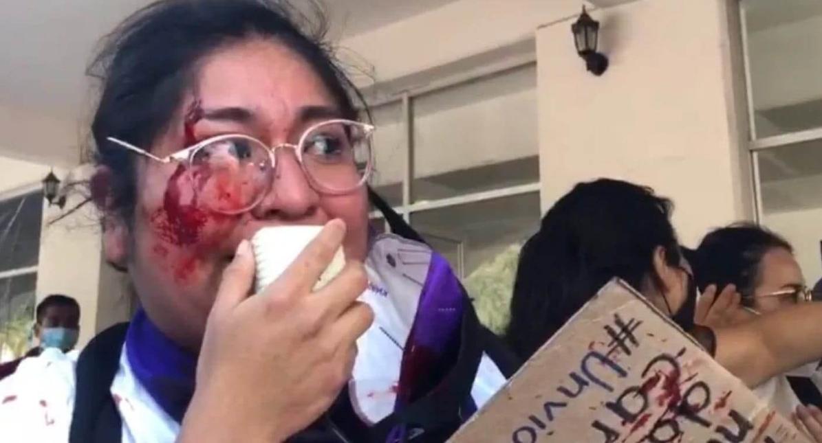 Fotografía: Difusión